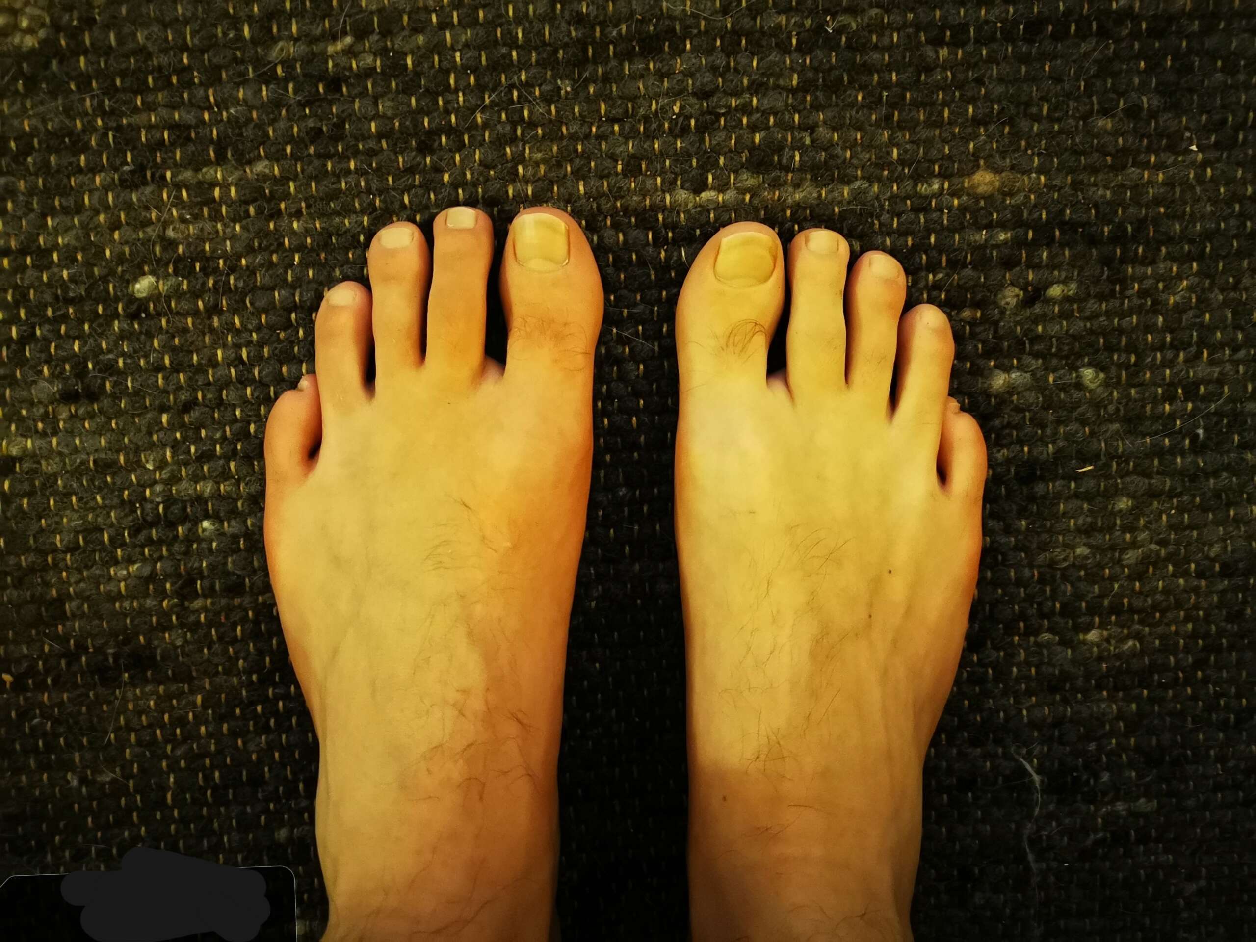 Tenen lezen - Praktijk voor optimale gezondheid